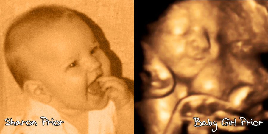 Sharon vs Baby Girl Prior